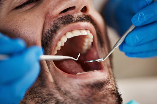 Best Emergency Tooth Extraction  in Beardstown, IL