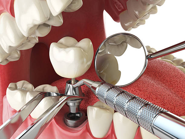 Best Emergency Dentist Near Me  in Beardstown, IL